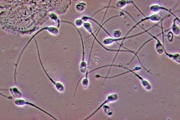 High Levels of Air Pollution Lead to Poor Sperm Quality 